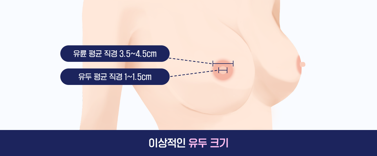 유두성형