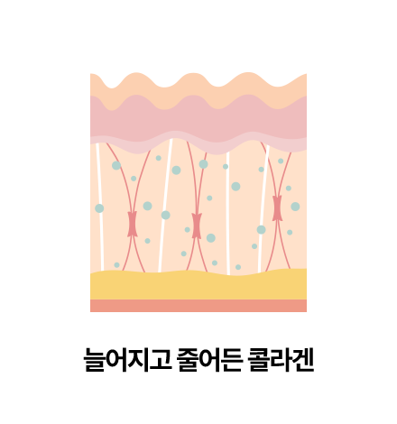 늘어지고 줄어든 콜라겐