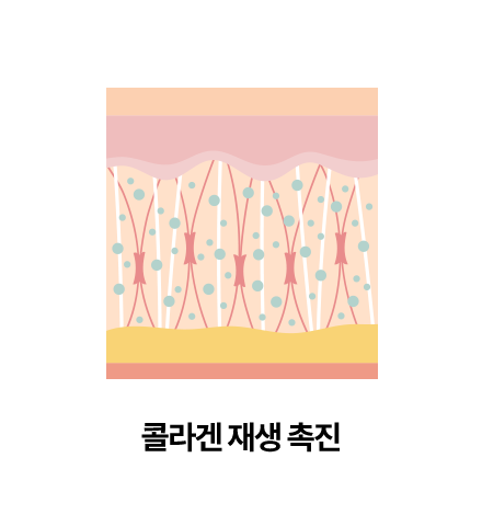 콜라겐 재생 촉진