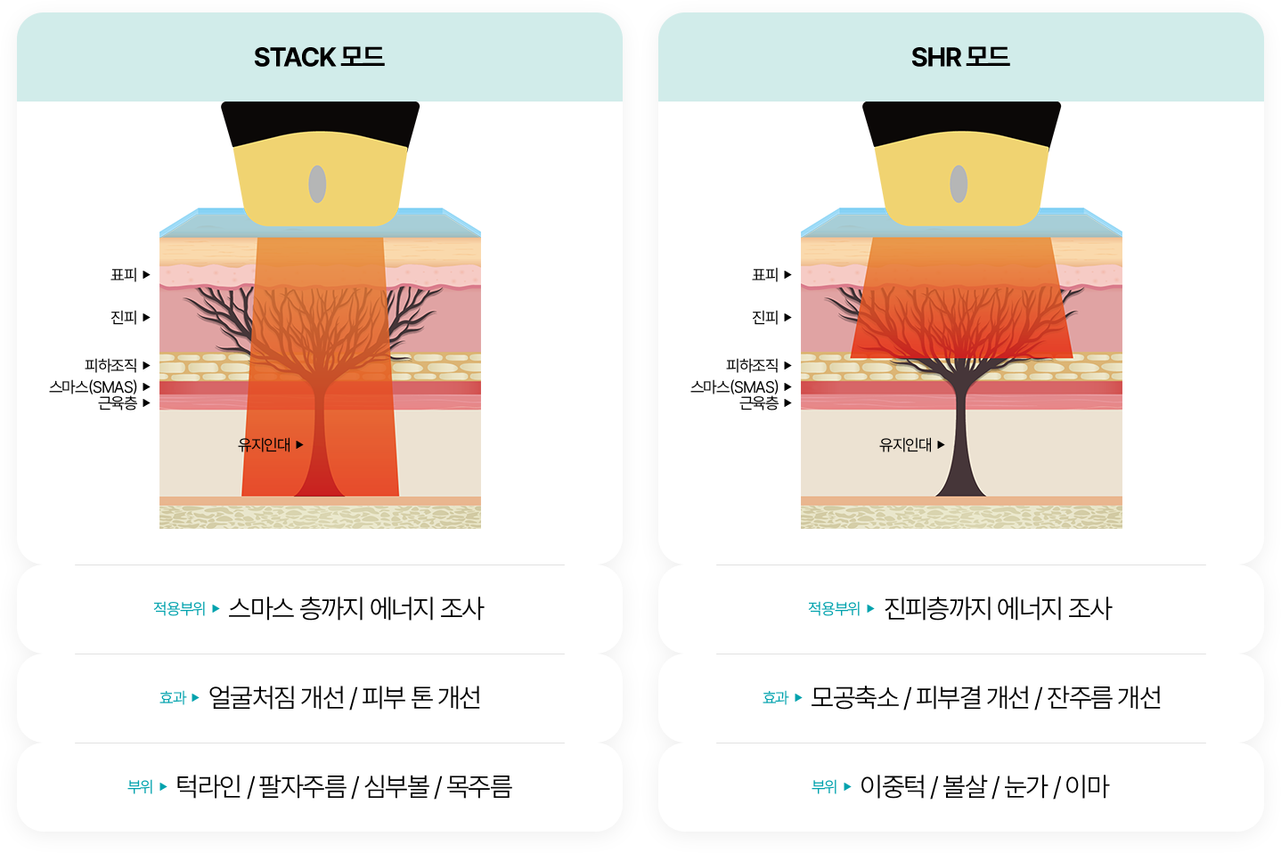STACK모드 SHR모드