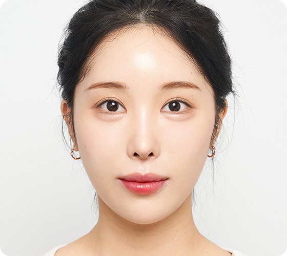 #필러 #보톡스 #듀얼라인리프팅 #윤곽주사