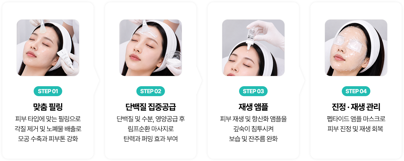 시바산 시술과정