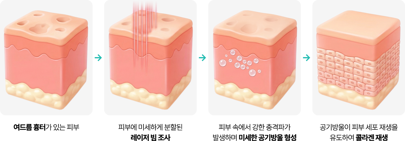 프락셀 제나의 원리
