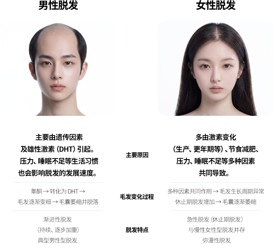 脱发形成原因