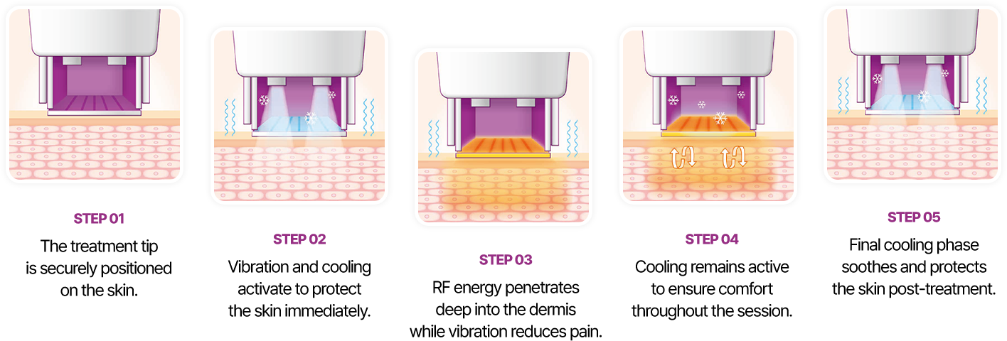 STEP