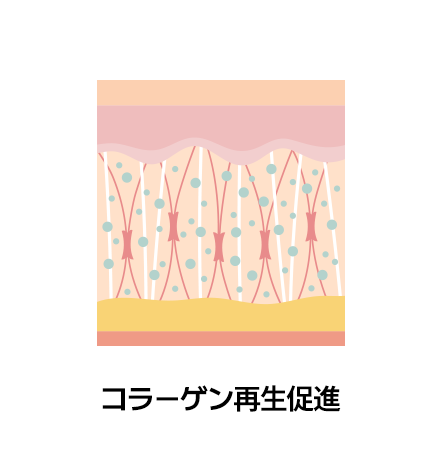 콜라겐 재생 촉진