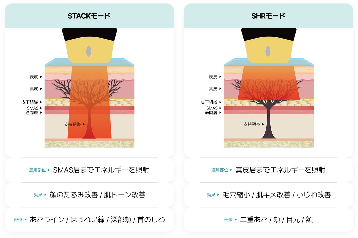 STACK모드 SHR모드